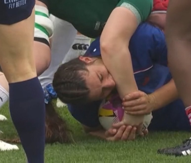 😬 We have a biting incident in the Women’s World Cup… 

#RWC2025