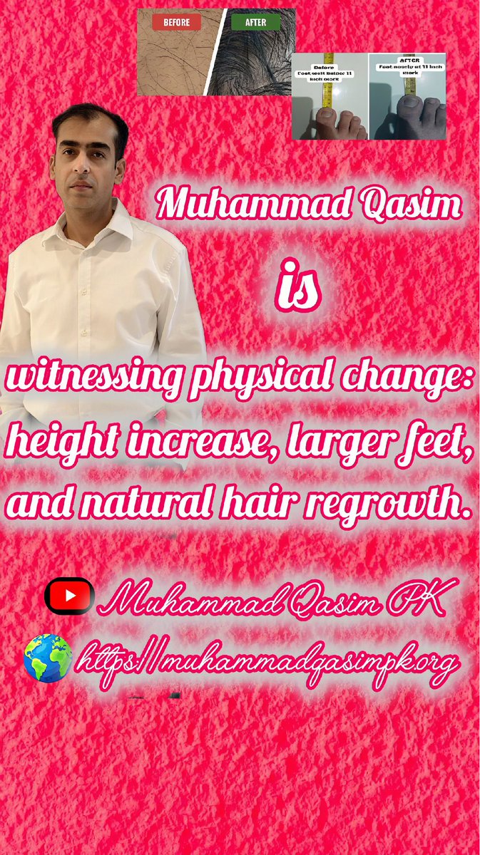Hair is returning and strength is building in Muhammad Qasim, even at an age when decline is expected. 

Muhammad Qasim