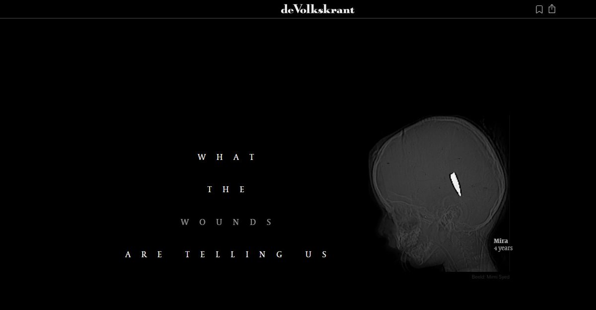 International doctors who worked in Gaza say they repeatedly treated children with single gunshot wounds to the head or chest, injuries suggesting deliberate targeting by Israeli snipers or drones. 

They documented at least 114 such cases along with evidence of fragmentation