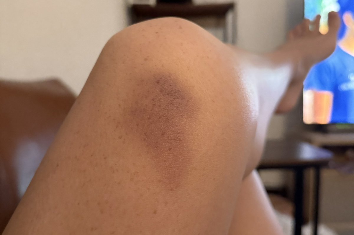 Anna 🫶🫶🫶 tweet media