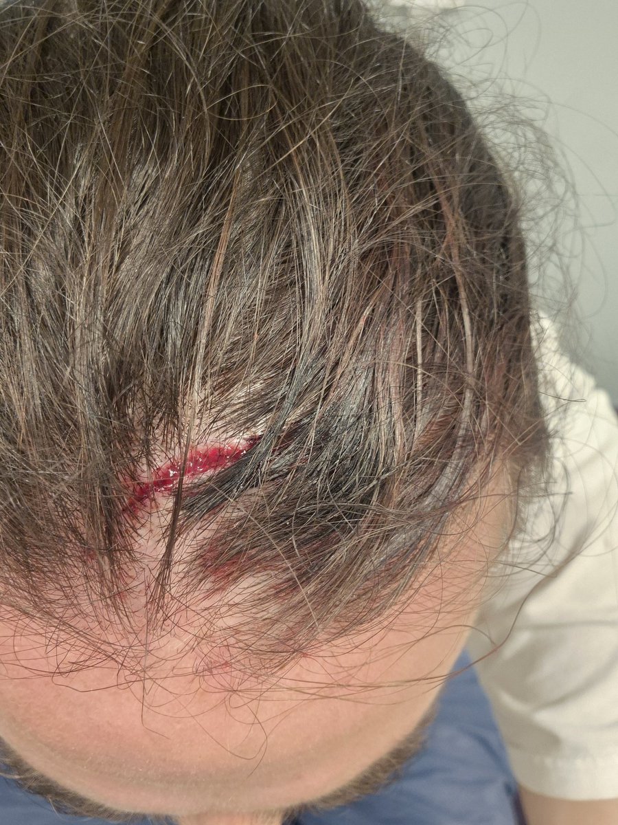 Flibbens's tweet image. Kul grej det här med att kasta fulla ölmuggar upp i luften. Från övre till nedre. Fick iaf se 2-0.

Trist om vi inte kan få fortsätta dricka öl i sköna glas, för det gillar jag faktiskt.

#Bajen