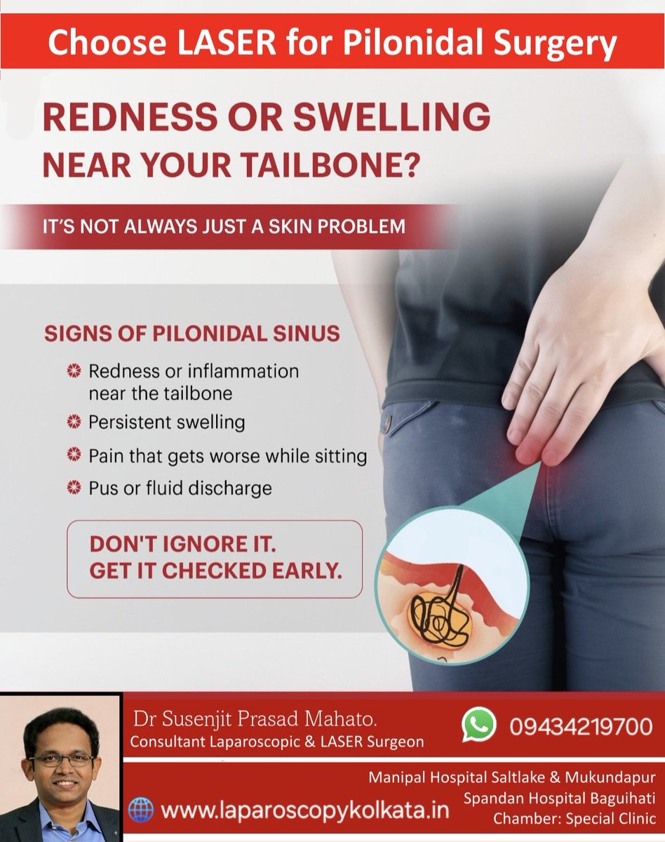 DrSusenjit's tweet image. ⚠️ LASER Surgery for Pilonidal Sinus surgery means.. no pain, no bleed &amp;amp; less stay in hospital.

✅️ You can watch our youtube video on LASER Surgery of Pilonidal Sinus.
youtu.be/t4PczwHStE8

#pilonidalsurgery #LASER
#lasersurgeon #lasersurgery #pilonidalsinus #pilonidalcyst