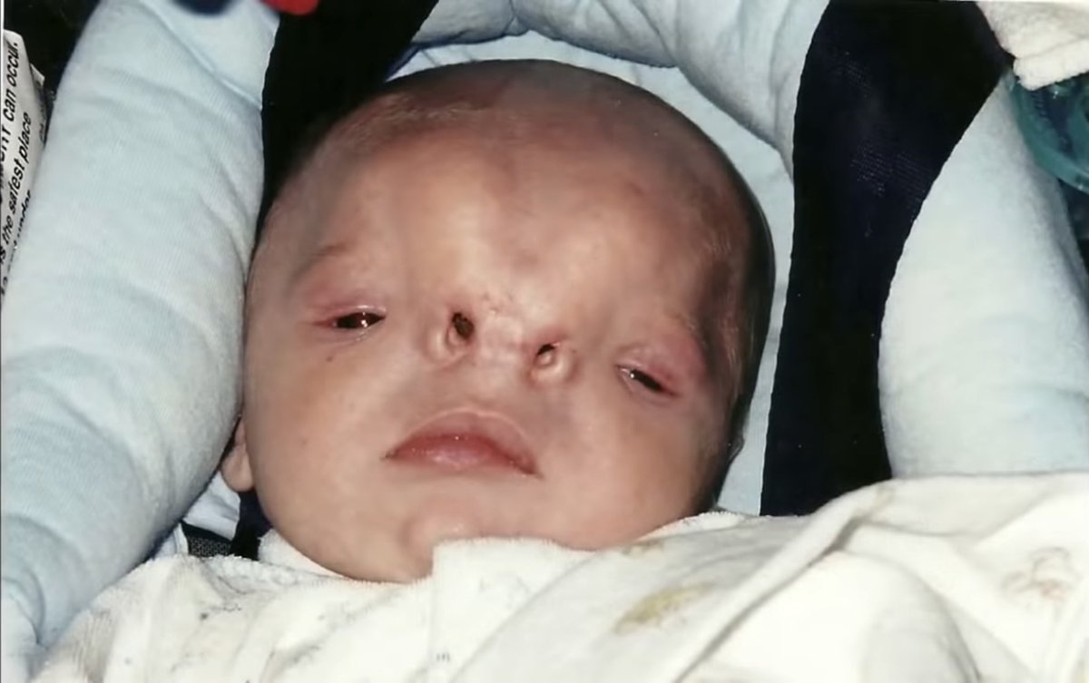 I’m a video editor whose work has earned over 3 billion views—and I was born without a nose. My goal has always been to show that with hard work and determination, you can achieve anything, no matter what challenges you were born with or what obstacles you’re facing

If you have