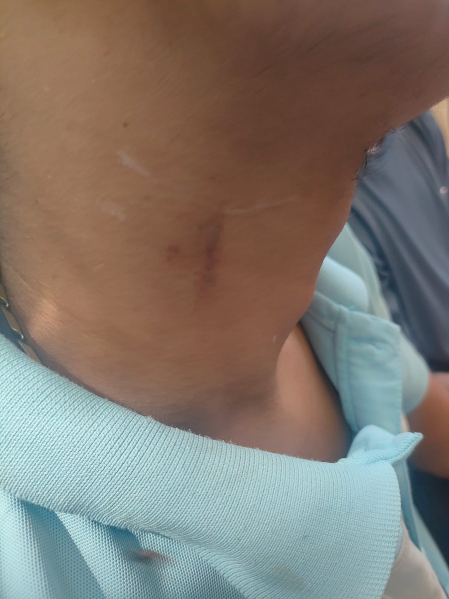 RishabhSin5159's tweet photo. #StudentRights #JusticeForStudents
#HostelRules #StudentSafety
#NHRC #EducationMinistry #UGC
#BundelkhandUniversity
#BUJhansi
@Mayawati
@RahulGandhi
@BhimArmyChief
@HansrajMeena
@SanjayAzadSln
@DalitDastak
@bhimarmy_official https://t.co/kB23VabOFO