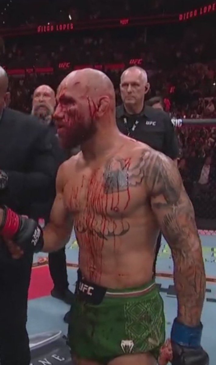 diegoatlopes's tweet image. Too ez #UFCNoche