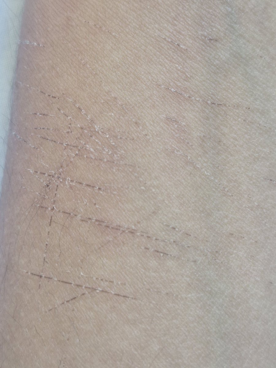 ₊˚ʚ♡ɞ sunny !! ˙⊹܀ೀ tweet media