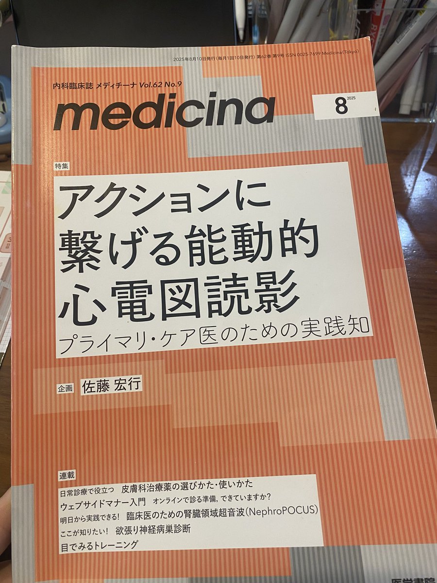 心内局所電位 アブレーション EPS 【公式通販】