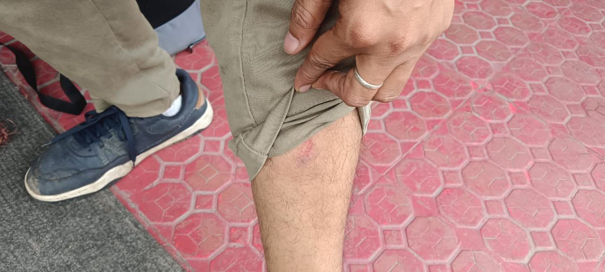 airnowindia's tweet photo. बिहार पुलिस की लाठीचार्ज में Air Now के वीडियो जर्नलिस्ट को चोट आई है। नीतिश कुमार की पुलिस लाठी चार्ज करने में इतनी एक्सपर्ट हो चुकी है कि उन्हें कुछ नजर ही नहीं आता।
 #Daroga #Patna #Policelathicharge #darogaVacancy #Bihar #Darogavacancy https://t.co/CQTxhh5L5U