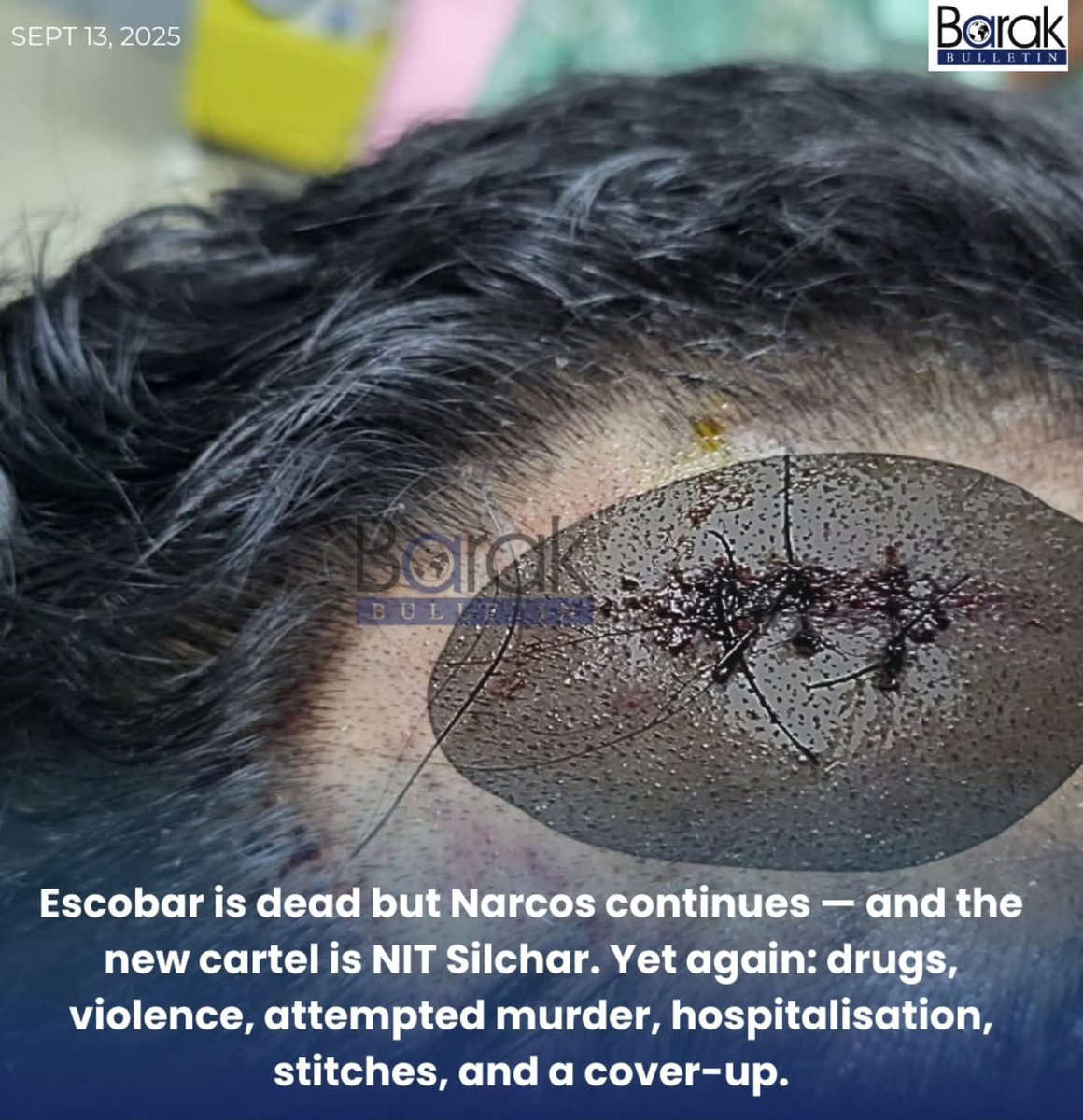 HinduVoice_in's tweet photo. #Asssam
What is happening in NIT Silchar, is very alarming.
Bangladeshi Muslim students are running gangs there. Drugs, alcohol and gangs with sharp weapons are very normal.
Because of the Bangladeshi Muslim students, Indian students live on campus with fear.
Two days ago, violence broke out between two gangs of Bangladeshi Muslim students. Both groups stabbed each other with sharp weapons.
But strangely, the head of NIT Silchar didn't file any FIR. It's high time that Bangladeshi students should be allowed there.
#NITSilchar