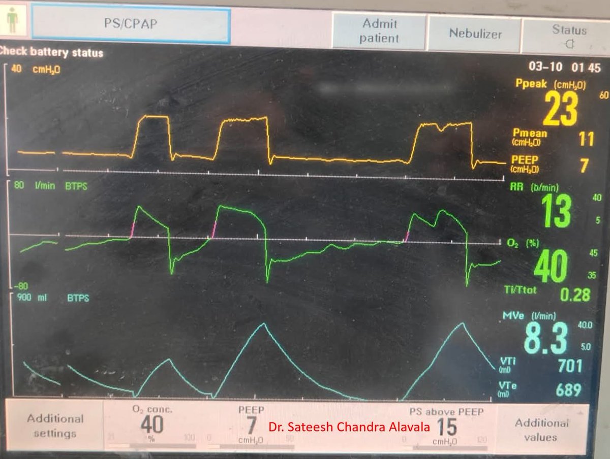 How would you interpret this waveform?
