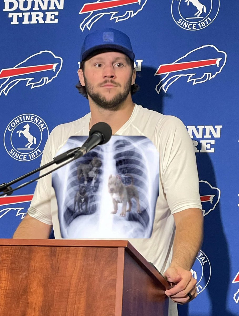 Josh Allen at his post game interview yesterday