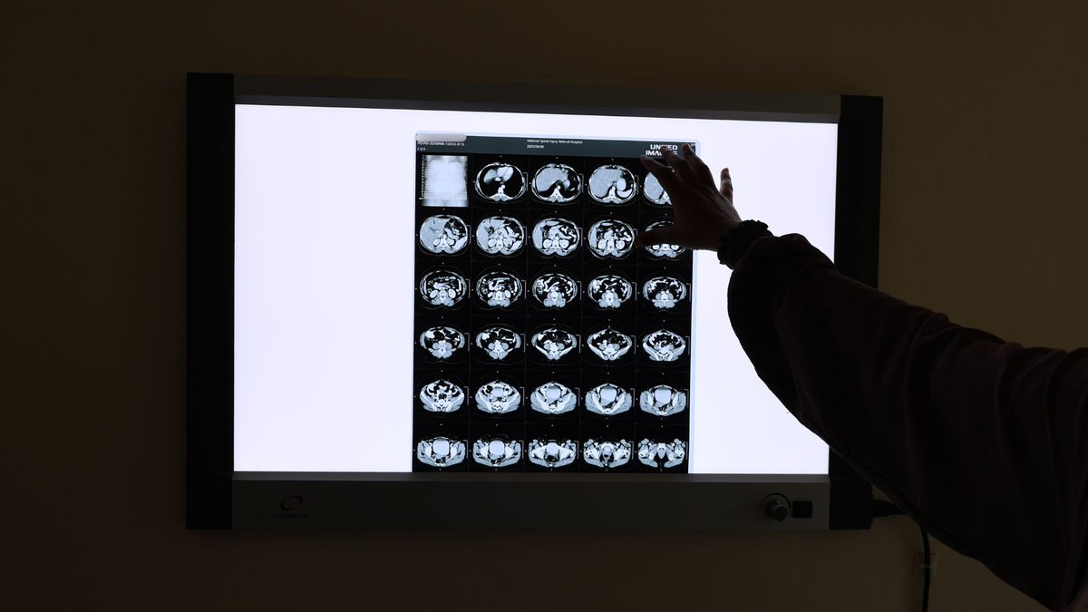 Sunviewmedipro's tweet photo. Our newest CT scan at the National Spinal Injury Referral Hospital is now functioning.
Patients in Nairobi now have access to the latest diagnostic imaging technology, offering faster, clearer and more accurate scans.
#SunviewMedipro #CTScan #NESP #empoweringeverycare https://t.co/oBpigXN0ce