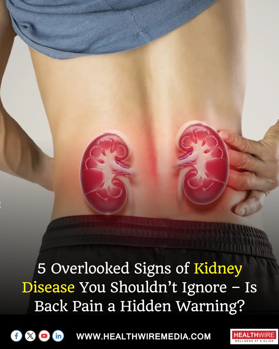 HealthwireMedia's tweet image. News that You might have missed! Stay Updated with Healthwire Media

#donaldtrump #trumphealth #stroke #medicalcondition #kidney #kidneydisease #backpain #healthnews #healthupdate #healthwiremedia