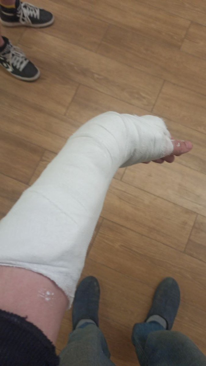 2 days ago I asked my wife - do you think there is a chance that I will live my whole life without breaking bones? 

 Today...