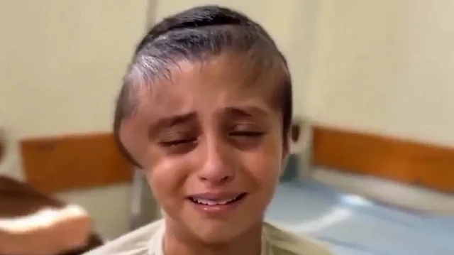 “Yaşamak istiyorum, çocukluğumu elimden aldılar”

📌İsrail'in saldırısında kafatası parçalanan Han Yunuslu 12 yaşındaki Meryem İbrahim'in sağlık durumu kötüleşiyor. Kafatasının parçalanan kemikleri hala Nasser Tıp Kompleksi laboratuvarda saklanıyor. Soykırım nedeniyle sağlık