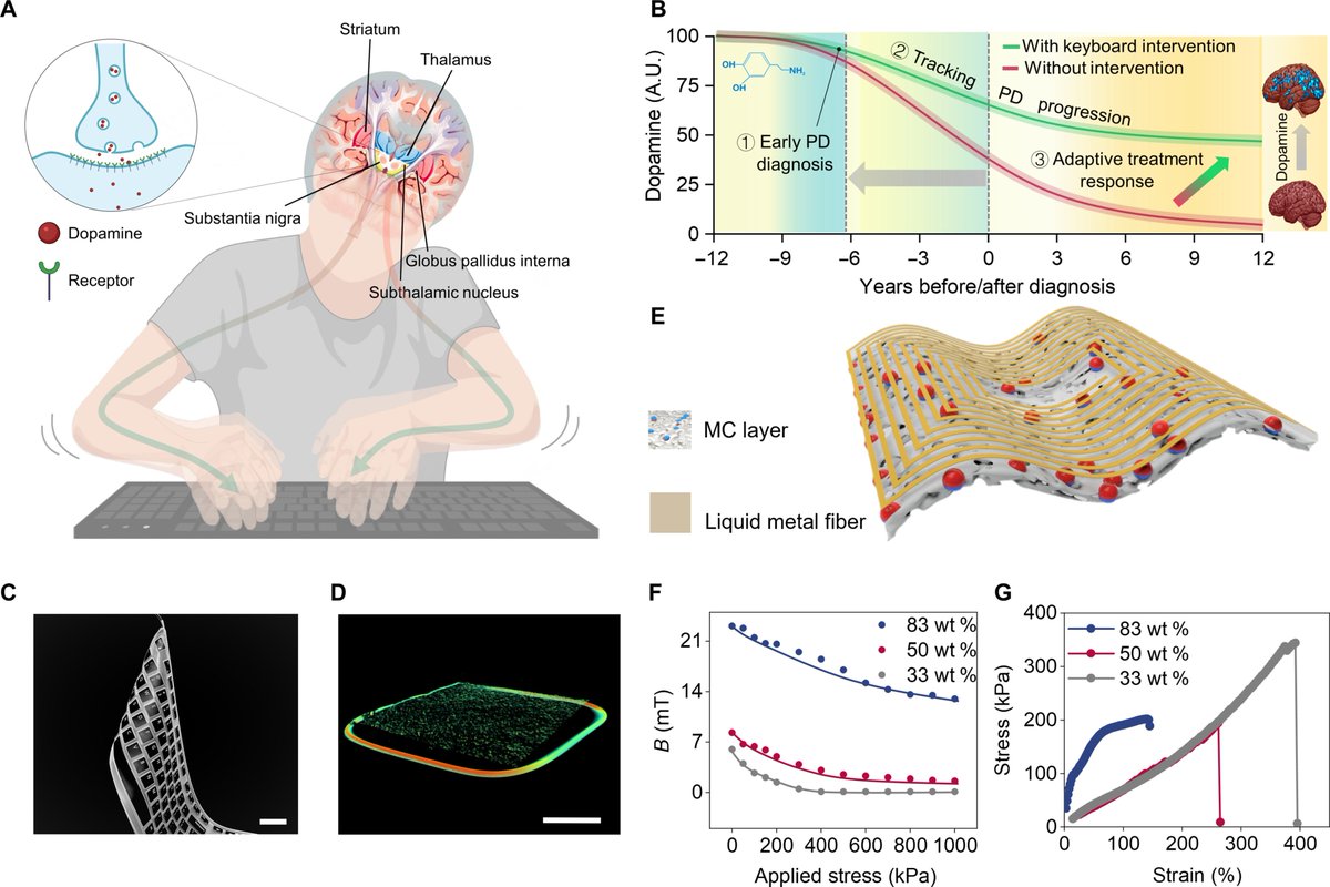By converting keystrokes into electrical signals, this keyboard can diagnose Parkinson’s dementia with an accuracy of 96.97%.