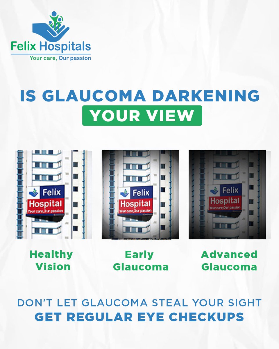 WellnessFelix's tweet image. Glaucoma—the “silent thief of sight”—causes gradual, unnoticed vision loss. By the time symptoms appear, damage is often irreversible. Regular eye exams after 40 are crucial for early detection and treatment.

#GlaucomaAwareness #SilentThiefOfSight #EyeHealthMatters #VisionCare