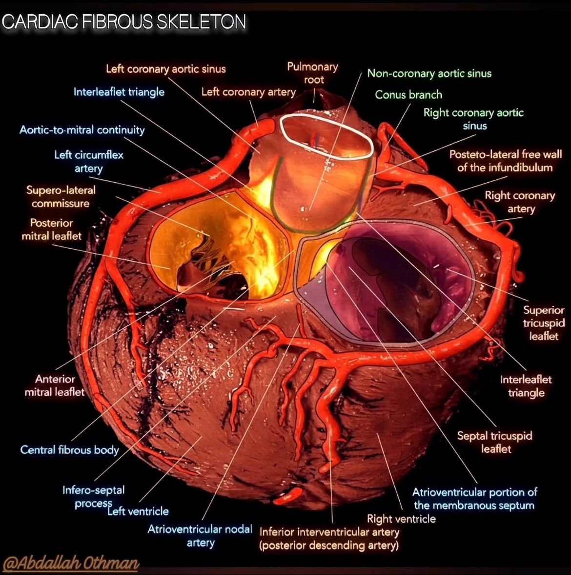 The fibrous skeleton is the heart’s true foundation.
This transilluminated view reveals the aortic root with mitral &amp; tricuspid valves, anchored by the central fibrous body.
Where valve mechanics, conduction &amp; surgery converge.

#CardiacSurgery #Anatomy #BehindTheScalpel
Image