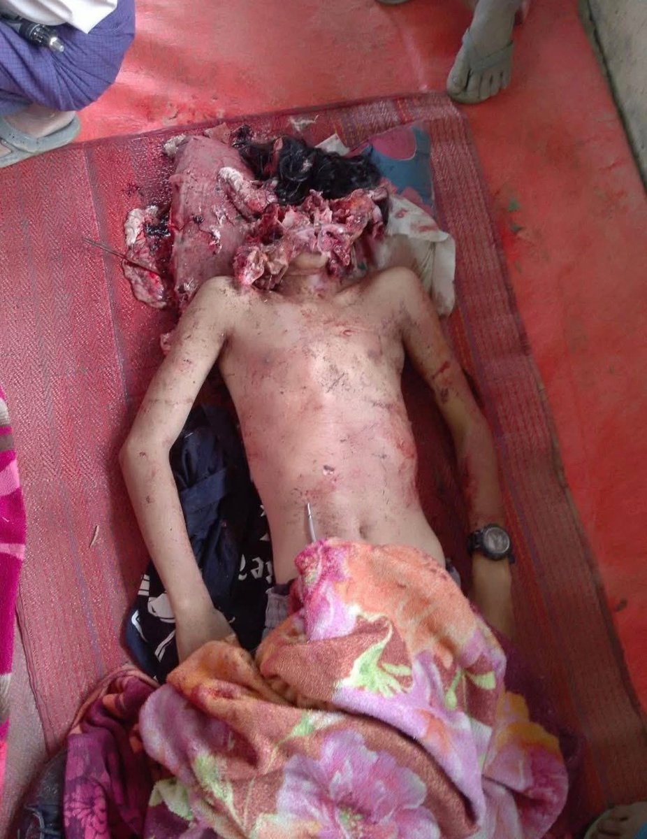 NaingSome9150's tweet photo. #StopKillingChildren #WarCrimes #Arakan #terroristMyanmarMilitary #RaiseYourVoice
#StopMyanmarJunta #AirstrikesOnCivilians
#JusticeForMyanmarPeople #SchoolsAreNotTargets #ChildrenUnderAttack
#StopWarCrimes #ProtectCivilians
#EndJuntaTerror #UNActNow
#NoMoreWordsTakeAction https://t.co/pv3BhEHF19