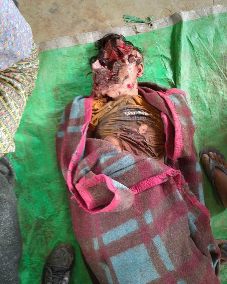 NaingSome9150's tweet photo. #StopKillingChildren #WarCrimes #Arakan #terroristMyanmarMilitary #RaiseYourVoice
#StopMyanmarJunta #AirstrikesOnCivilians
#JusticeForMyanmarPeople #SchoolsAreNotTargets #ChildrenUnderAttack
#StopWarCrimes #ProtectCivilians
#EndJuntaTerror #UNActNow
#NoMoreWordsTakeAction https://t.co/pv3BhEHF19