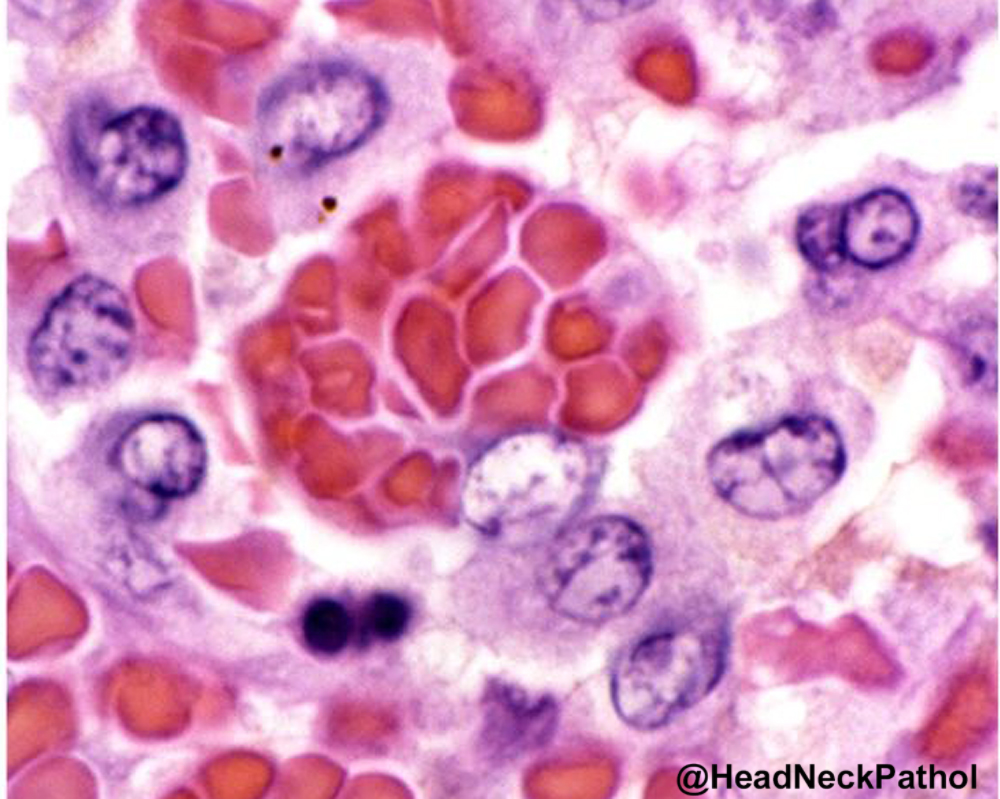 Head Neck Pathol tweet media