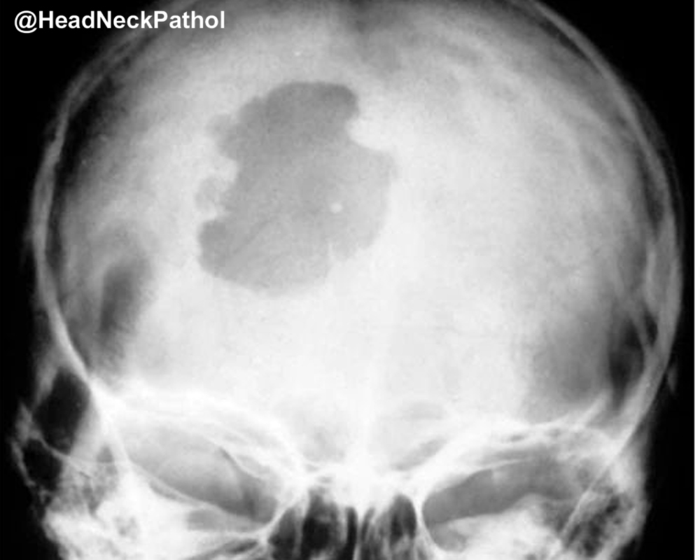 Head Neck Pathol tweet media