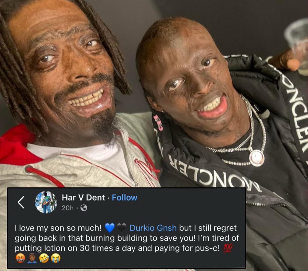 Father goes viral after reflecting on the day he saved his son life from a fire🙏