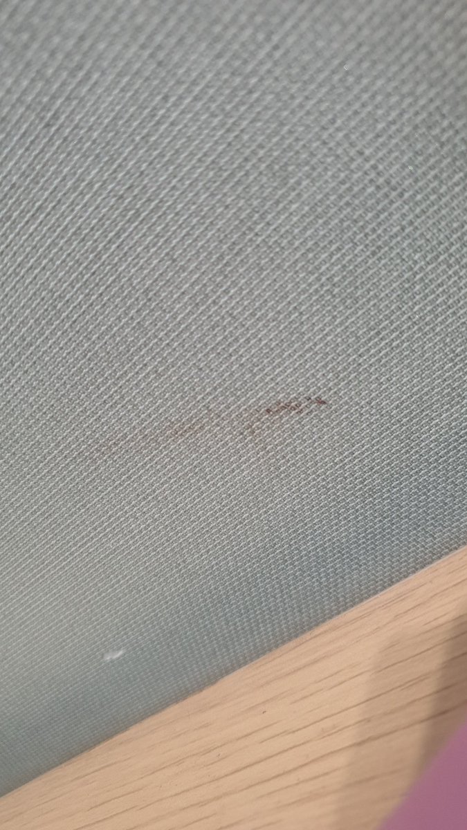 내 벽지 물어내 개새끼야
내피 얼마나 빨았으면 크기의 두베로 피가 터져