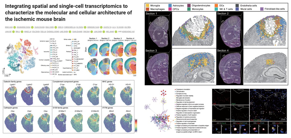 HaoYin20's tweet image. #SpatialTranscriptomics 🐭#Stroke

#Visium @10xGenomics
#Photothrombosis 3 dpi

Stroke▶️
⏫Microglia/Macrophage Galectin-1/3/9➡️ Astrocyte/Oligodendrocyte CD44 at peri-infarct zone▶️
⏫remyelination 
⏫neurobehavioral performance

Post-stroke benefits of LGALS9-expressing…