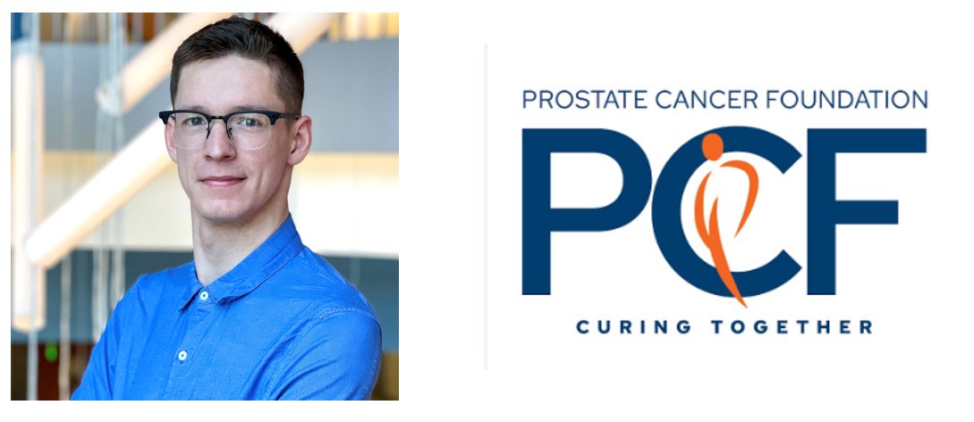 👏 Congratulations to Dr. Blaise Kimmel (<a href="/BlaiseKimmel/">Blaise Kimmel, PhD</a>) on receiving a <a href="/PCFnews/">Prostate Cancer Foundation</a> Young Investigator Award! His research develops targeted #nanobody-delivered drugs to overcome resistance and improve #immunotherapy for #prostate_cancer. <a href="/OSUCCC_James/">The James at Ohio State</a> <a href="/OSUengineering/">OSUengineering</a>