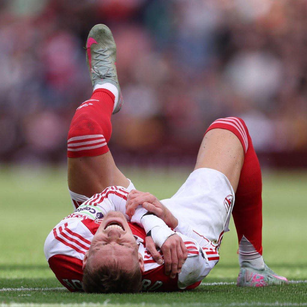 Ødegaard ruled out of Arsenal’s trip to Bilbao, Arteta confirms.
#pakuapakuazakispoti #UCL