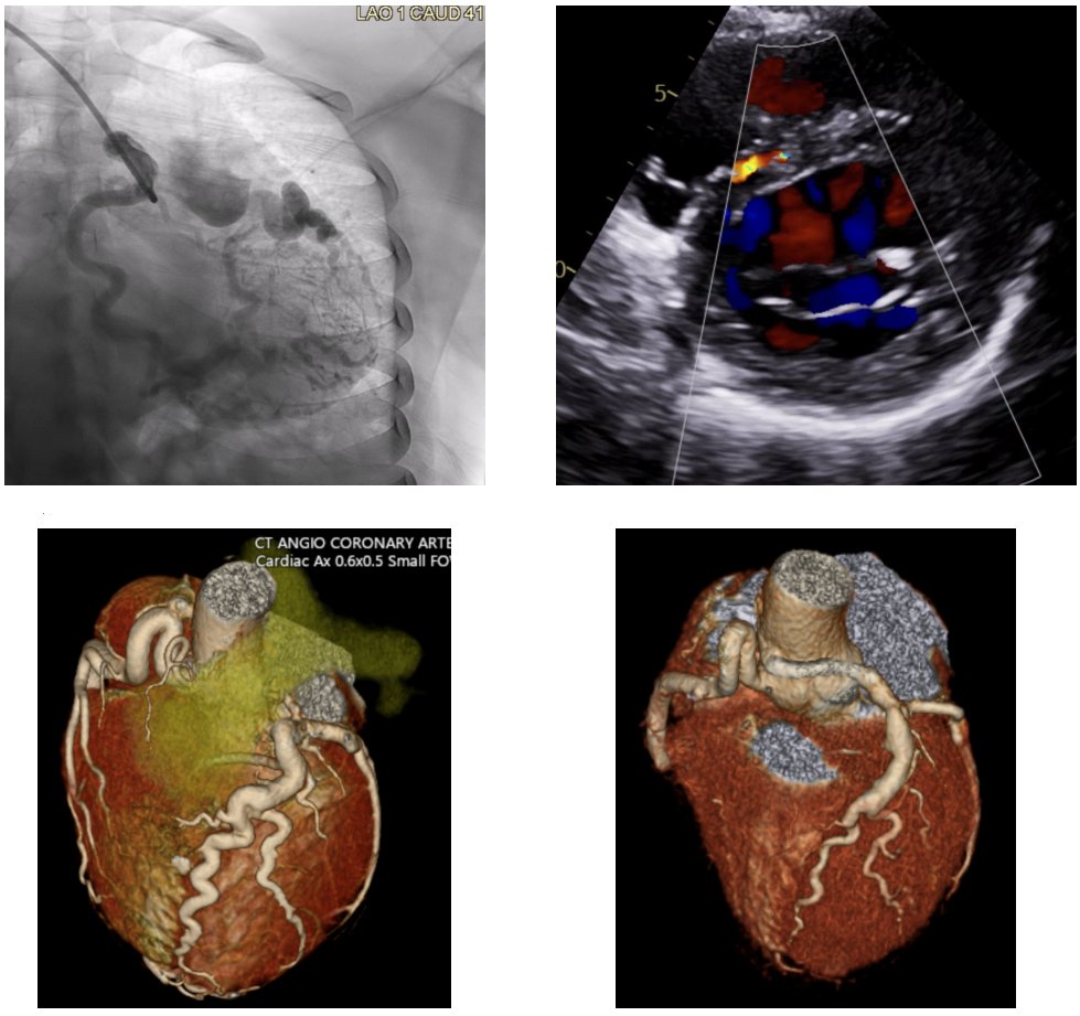 DeBakey CV Education - World Class CV Training tweet media
