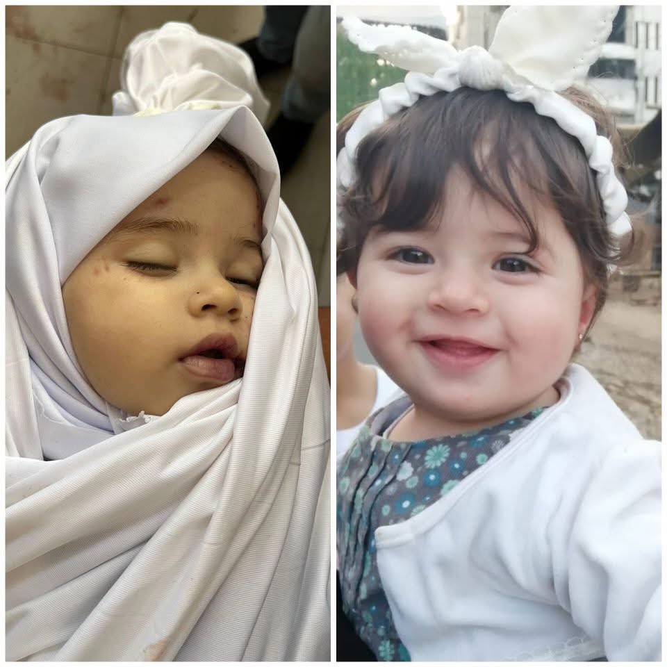 🚨Naya, just 1 year and 3 months old, survived an Israeli airstrike a year ago in Gaza when her clothes got caught on an iron rod, stopping her from falling through a gaping hole between two floors.

That same strike killed her mother, sister, grandmother, and uncle. She lived a