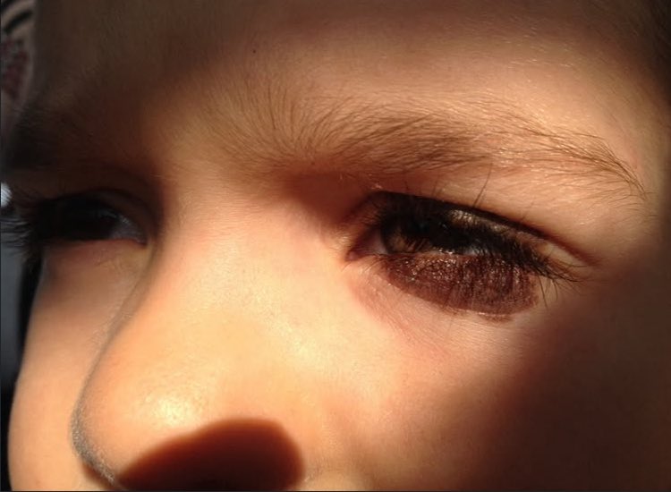 Bir sabah uyandığınızda evladınızın yanınızda olmadığını düşünün.
Düşüncesi bile insanın kalbini sıkıştırmaya yetiyor değil mi ?
O zaman bizim bu ailenin yanında olmak insanlık görevimizdir.
2 Ekimi Unutma.
Yanındayız Yasemin
#MattiaAhmetMinguzzi