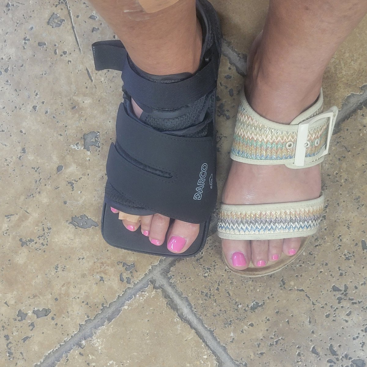 CarrieHKelly's tweet image. Looks like I may need pinky-toe surgery. Infection from reoccurring corn from small hammer toe. Bummer. #footcare #podiatry