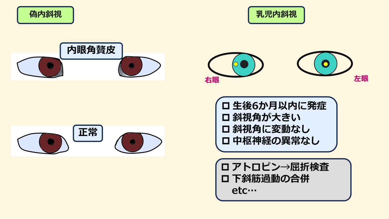 エスロト@眼科医 on X: 
