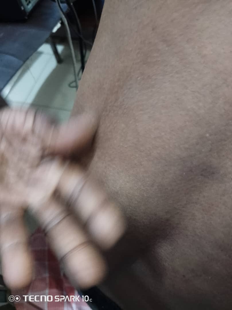 Liberatus80's tweet photo. Beaten for attending @TunduALissu’s court hearing. This is @SuluhuSamia’s Tanzania. #PoliceBrutality https://t.co/i7a8HZ12Wj