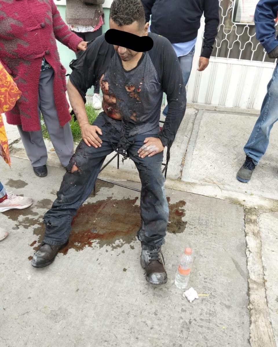 #Tlaxcala 💥💣 Cohete falla y explota en San Rafael Tenanyecac; dos heridos 😨 Un hombre y una mujer resultaron lesionados en la plaza Hidalgo. Autoridades piden reforzar seguridad en uso de pirotecnia.