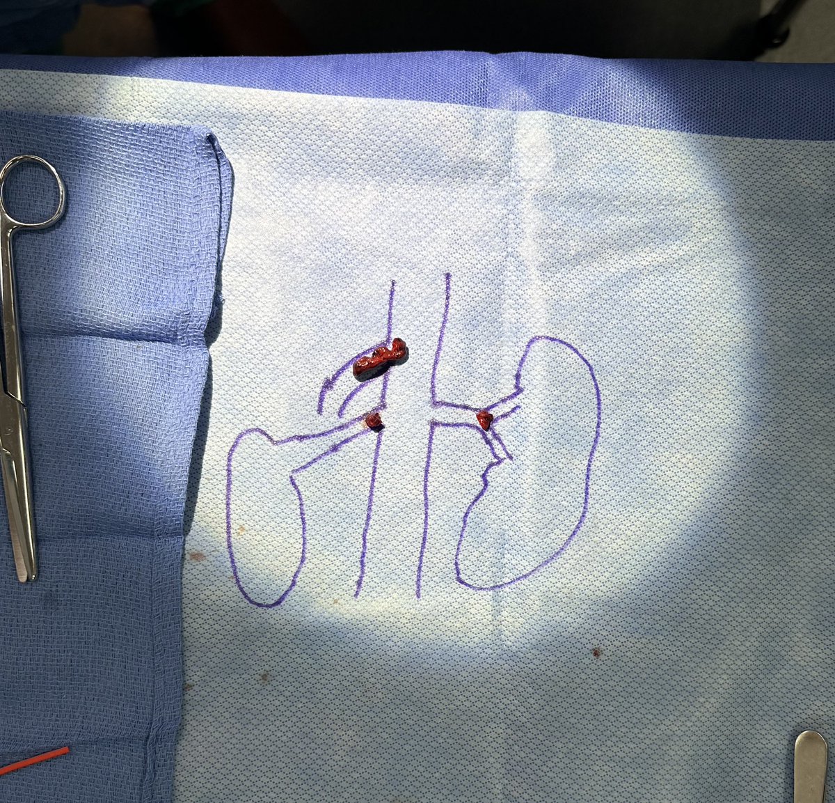 frank arko tweet media