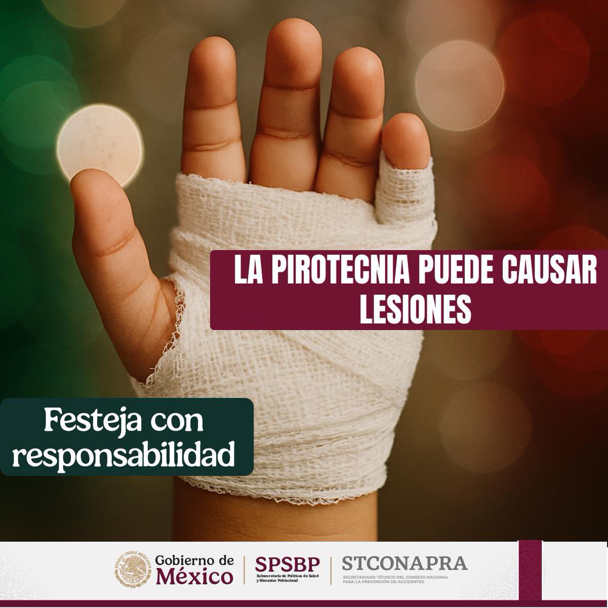 Una cicatriz que no debería existir.
🎆 La pólvora no entiende de edades. Cada año, niñas y niños sufren quemaduras, amputaciones y traumas.

🇲🇽 Este 15 de septiembre, celebra con orgullo… y con responsabilidad.

❤️🤍💚 Que tu noche sea motivo de alegría, no de lamentos.
#SPSBP