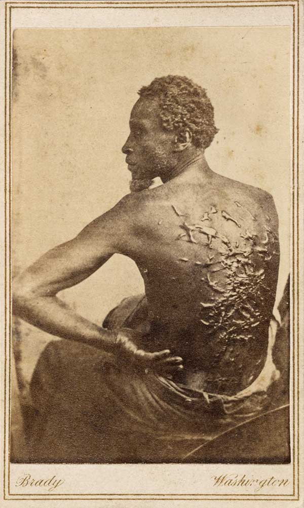 You may recognize this photo: it's one of the most famous (or infamous) visual representations of slavery in American History. The Trump Administration is ordering the removal of this photo - and many other artifacts - from museums around the nation.

Because history scares them.