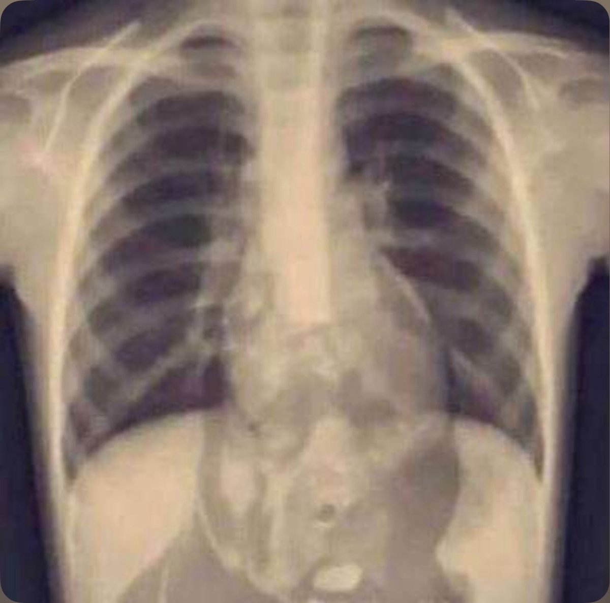 TheFFBallers's tweet image. Baker Mayfield