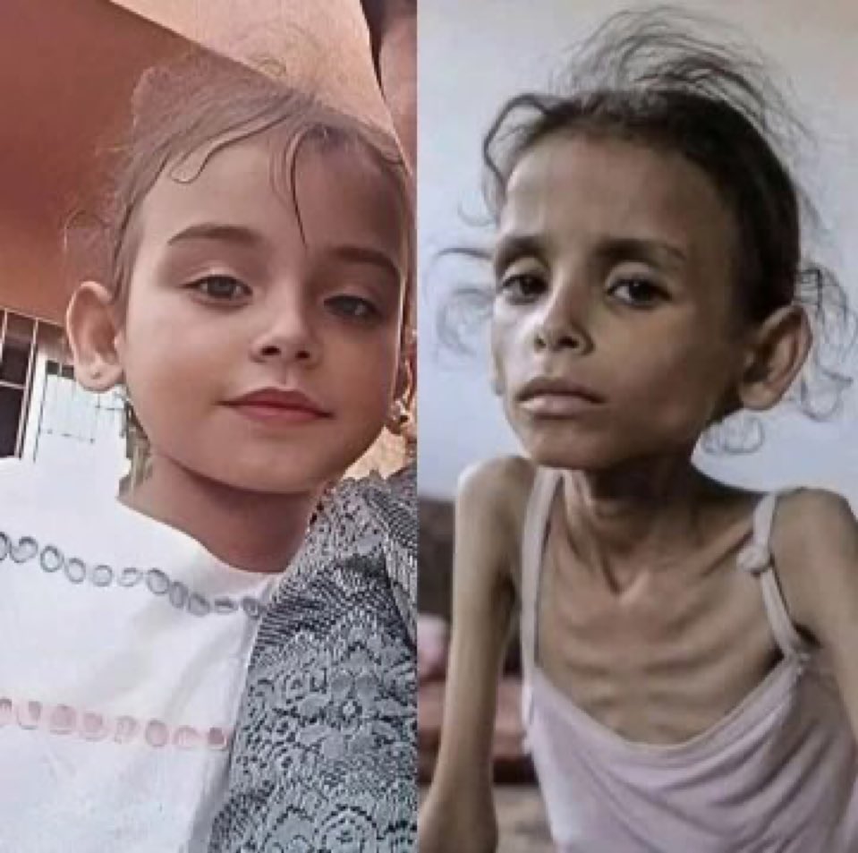 If u see this pretty angel, reply with 💔🇵🇸 Pray for her.💔