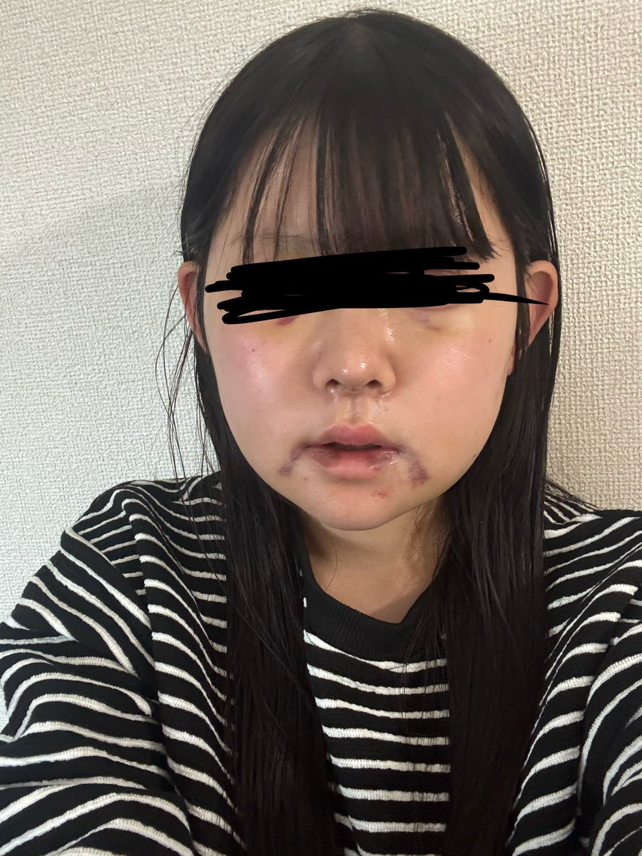 すずな🍏 tweet media