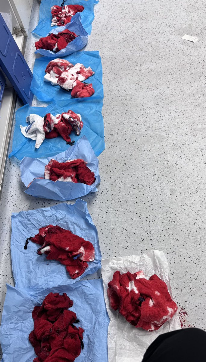 _DrNorah_'s tweet photo. واحدة من أكثر العمليات دمويّة اللي دخلتها

This was definitely one of the most intense, blood-filled surgeries I’ve experienced https://t.co/ptkBqFoRo4