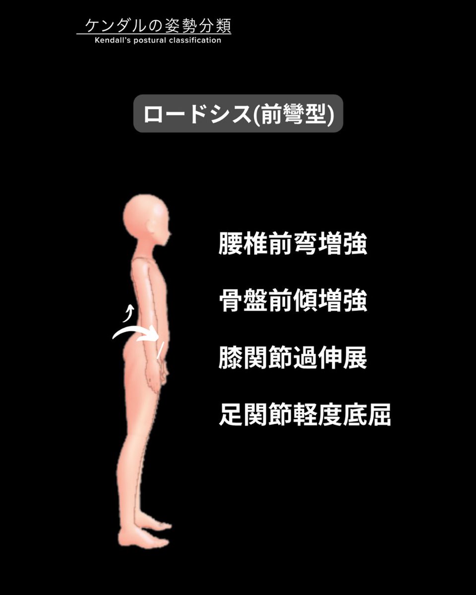 理学療法士の臨床と発信を支援するコミュニティ『forPT』 tweet media