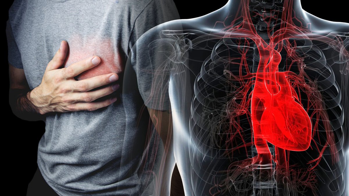Heart disease kills more Americans than anything else: 1 death every 30 seconds.

But science shows you can fight back. 

Here are 10 most powerful ways to improve heart health

A thread🧵