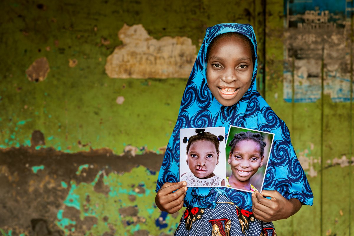 OS_DRC's tweet image. Observed annually on 17 September, #WorldPatientSafetyDay highlights the urgent need to expand access to safe, essential surgical care. This year’s World Health Organisation (WHO) slogan - “Patient safety from the start!” 
linkedin.com/feed/update/ur…