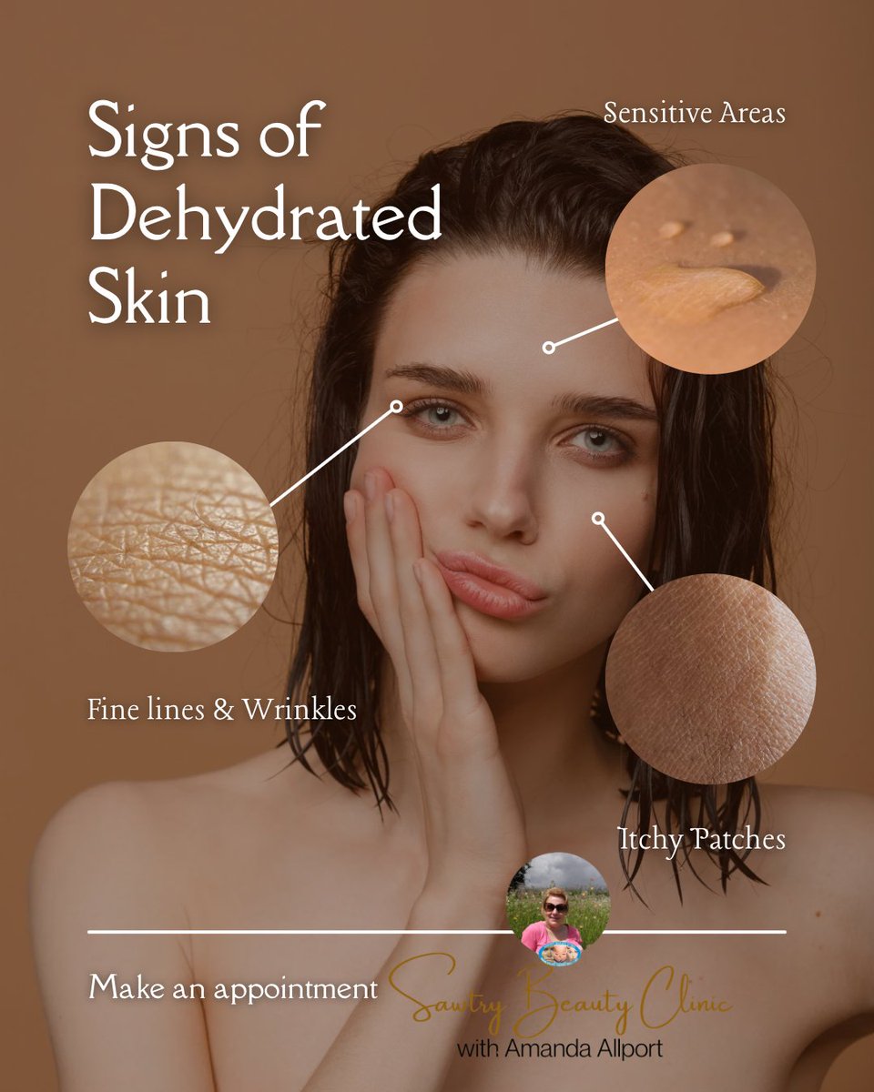 Noticing redness, irritation, or dry patches? These are signs of sensitive skin. 💢 Let’s calm things down — get £25 OFF your first treatment! #SensitiveSkin #SkinClinicUK #SawtryBeautyClinic