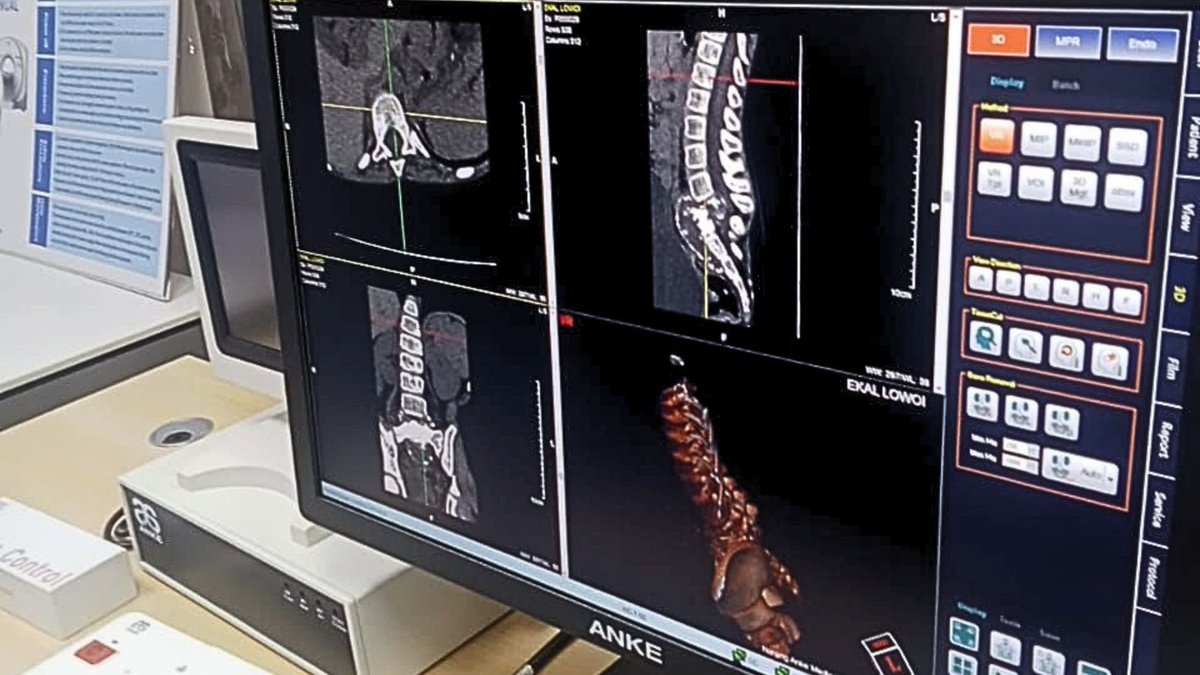 Following the 19 CT Scan installations across the country, Sunview has trained over 200 healthcare workers including radiologists, radiographers and biomedical engineers on how to operate the modern machines.
#SunviewMedipro #EmpoweringEverCare #radiology